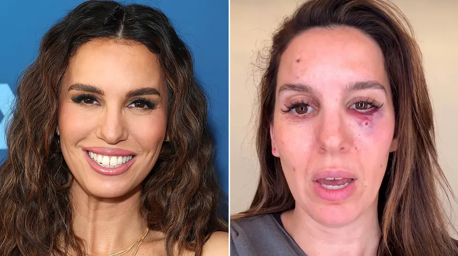 Christy Carlson Romano injured